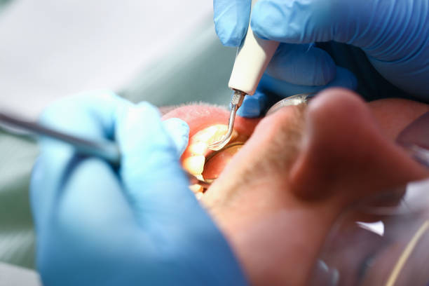 Best Emergency Gum Treatment in Beloit, OH