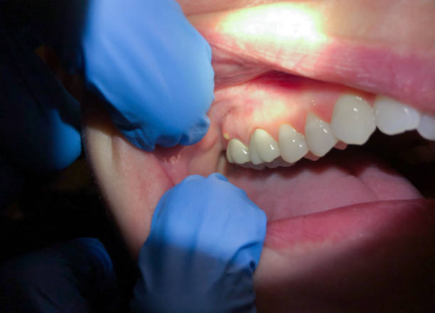 Best Cosmetic Emergency Dentistry in Beloit, OH