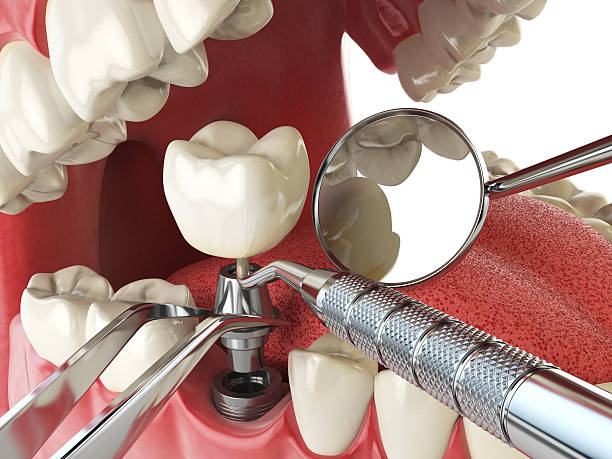 Best Emergency Denture Repair in Beloit, OH